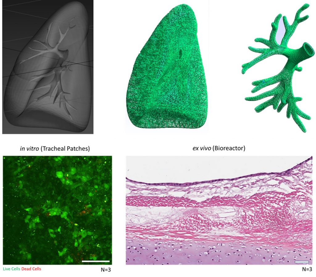RC/DC of Tracheal and Lung Scaffolds