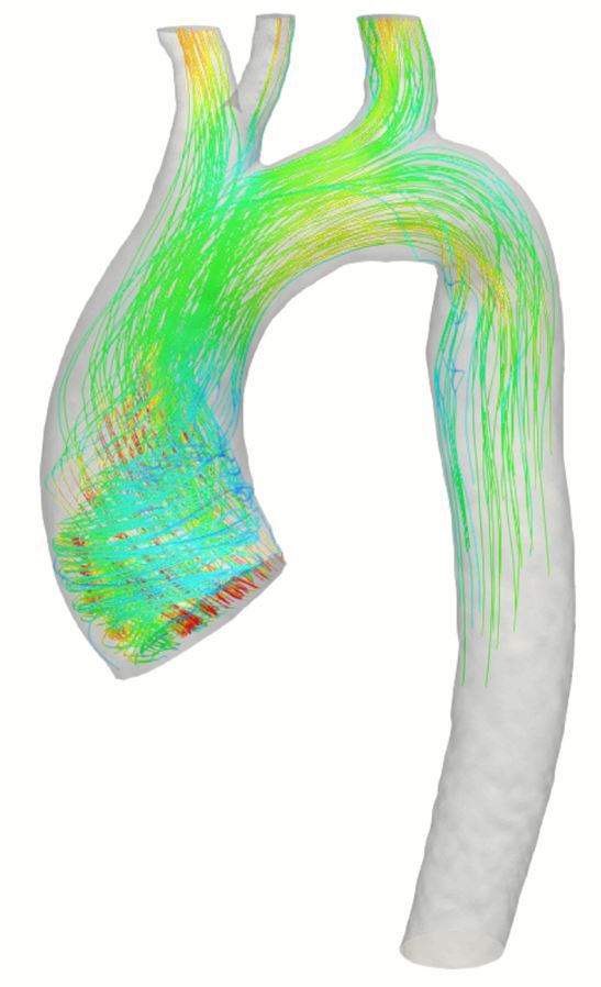 Cardiovascular Image