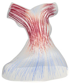 Surgical Planning Image