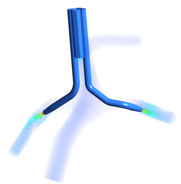 Surgical Planning Medical Device